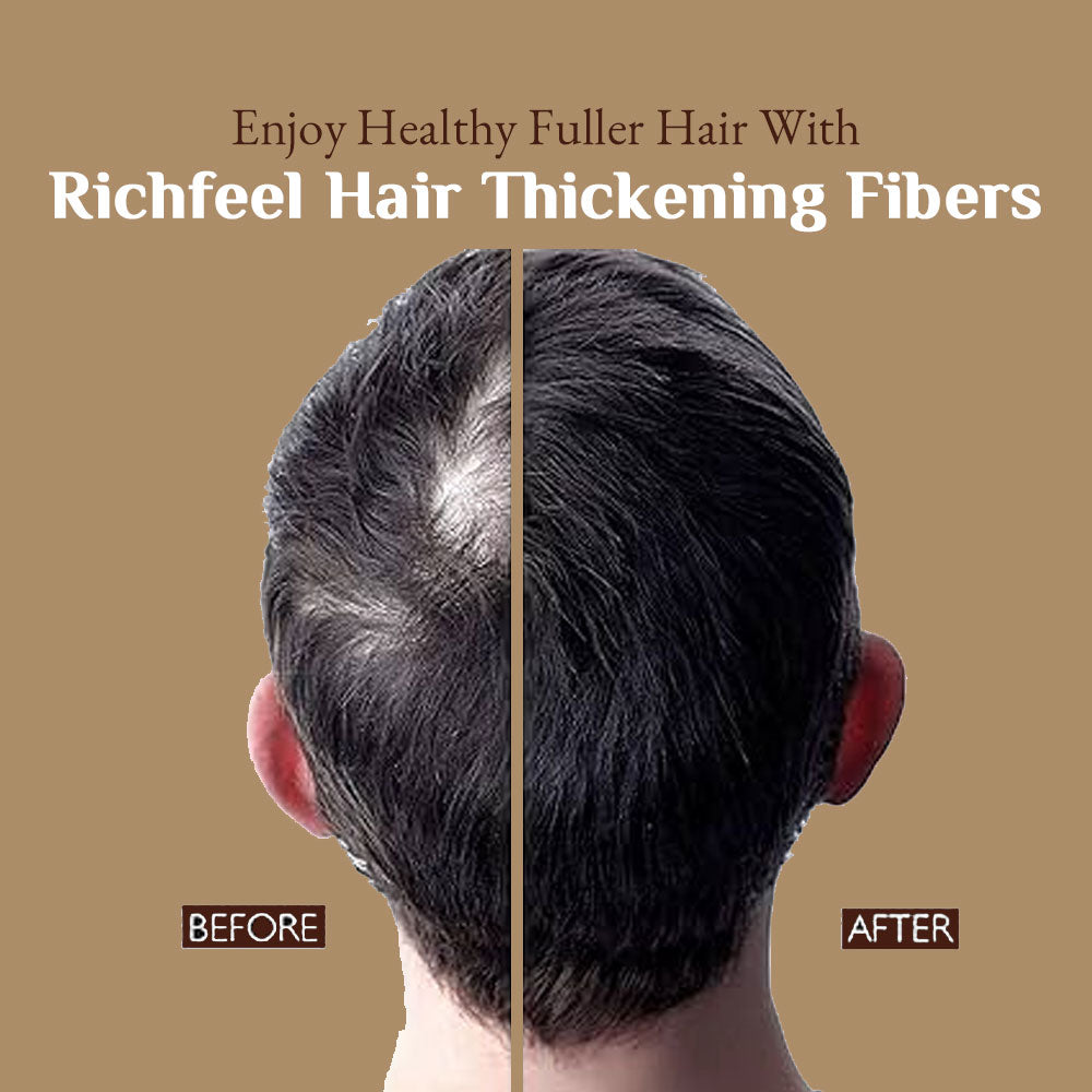 Richfeel Hair Thickening Fibers Dark Brown (B1G1) 28gm